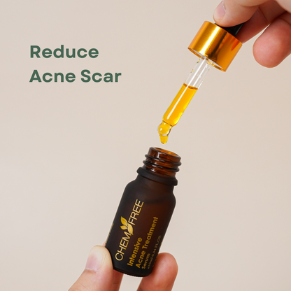 Intensive Acne Serum